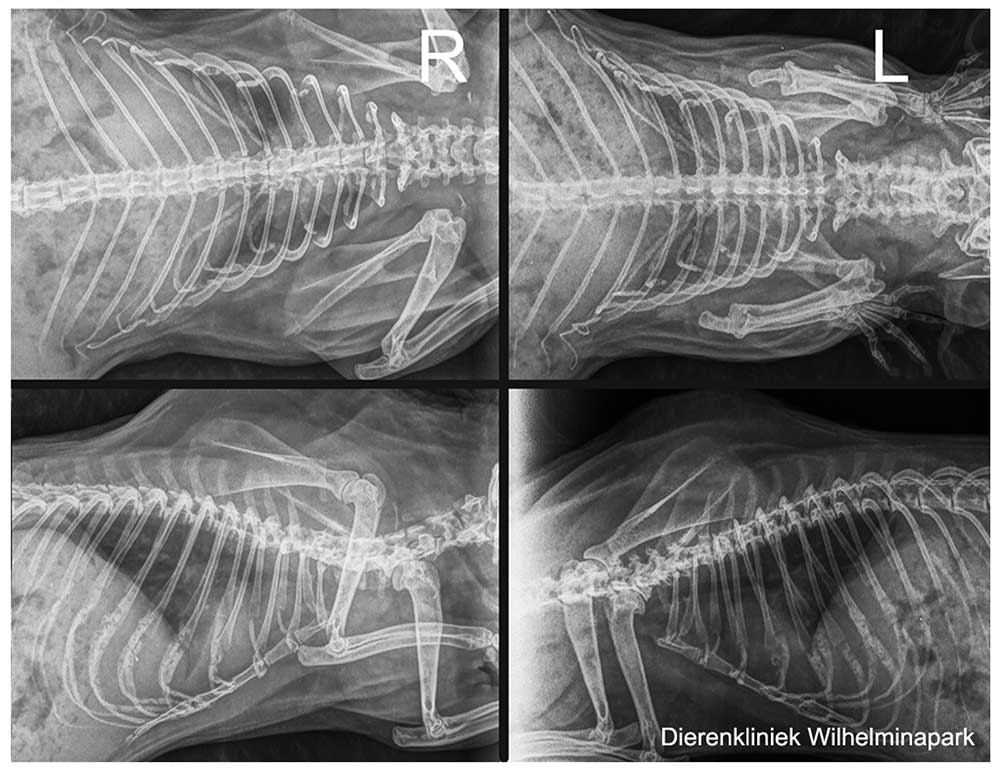 De rontgenfoto's die we van 4 kanten van een borstholte maken